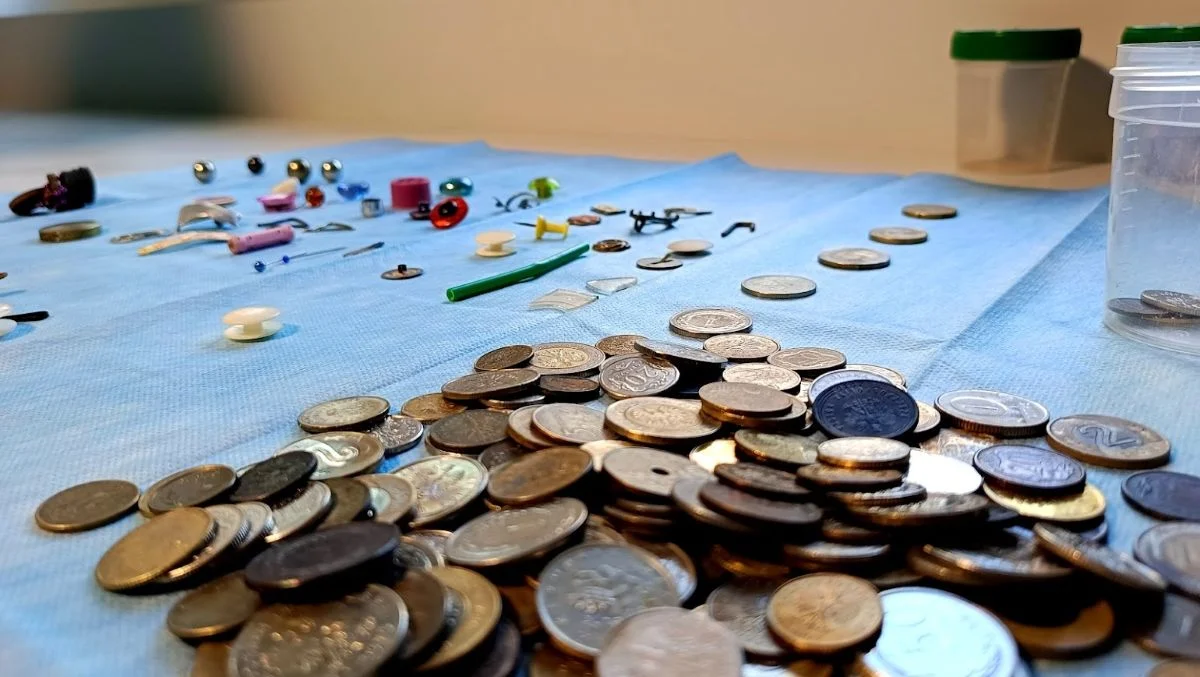 To mogło zabić! Gwoździe, bombki i kulki magnetyczne w brzuchach dzieci - Zdjęcie główne