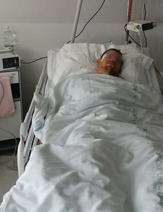 Brutalnie pobity mężczyzna wyszedł ze szpitala po pierwszej operacji