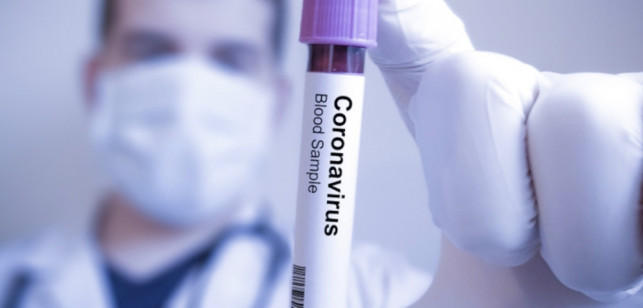 [KORONAWIRUS] W powiecie stabilnie, w województwie ponad 40 zakażeń, w Polsce 15 zgonów - Zdjęcie główne