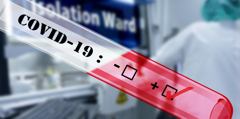 Kolejny przypadek koronawirusa. Mężczyzna hospitalizowany w Warszawie [RAPORT SANEPIDU] - Zdjęcie główne